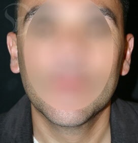 edited_left05