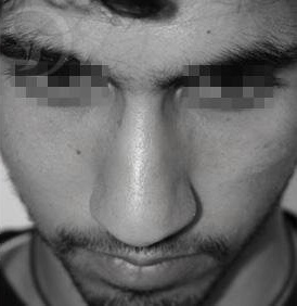 edited_right09