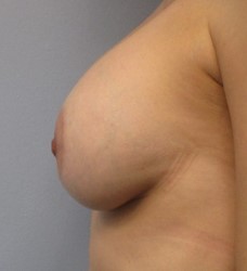 image_1