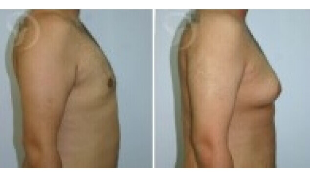 גניקומסטיה – תמונות