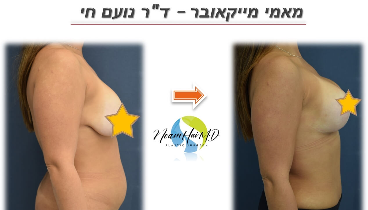 מאמי-מייקאובר-20